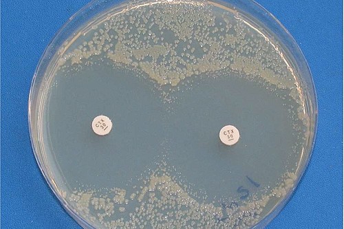 Petrischale mit Plättchen-Diffusionstest, mit dem die Antibiotikaresistenz von Bakterien untersucht wird .